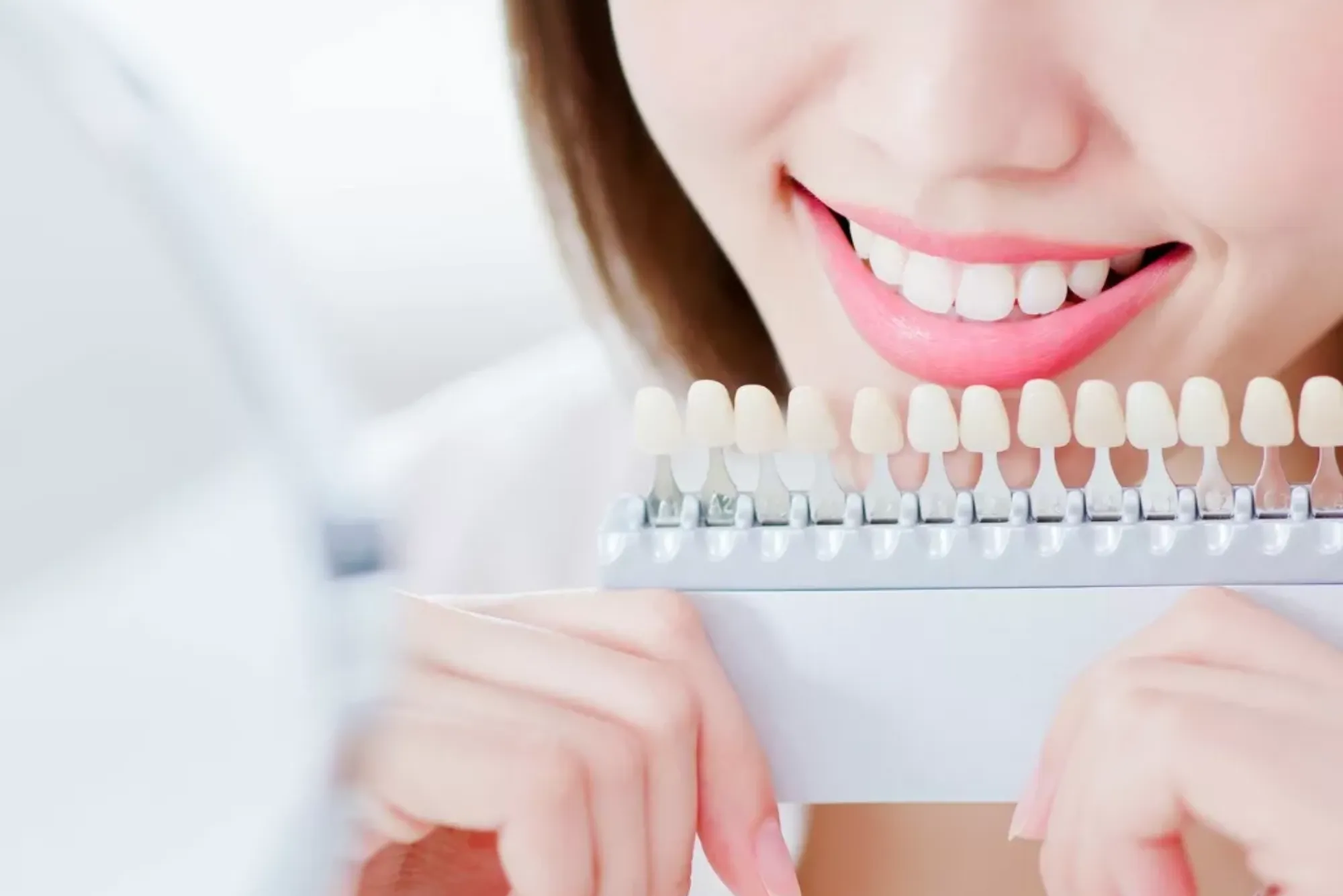 Best Clinic For Veneers In Dubai