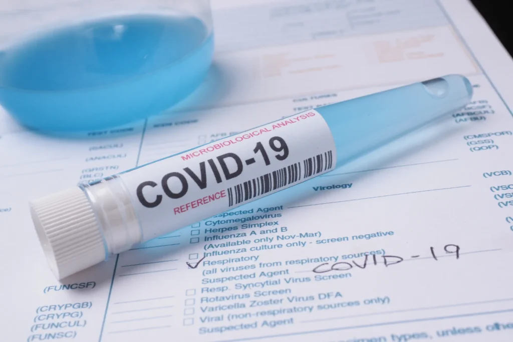 When Should You Get a COVID Test