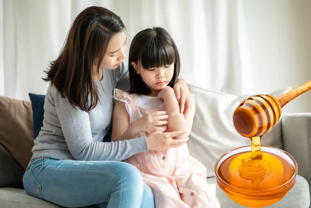 هل يمكن استخدام عسل مانوكا لعلاج الحروق والجروح؟